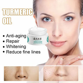 Japanese Melasma Cream