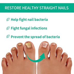 Nail fungus solution