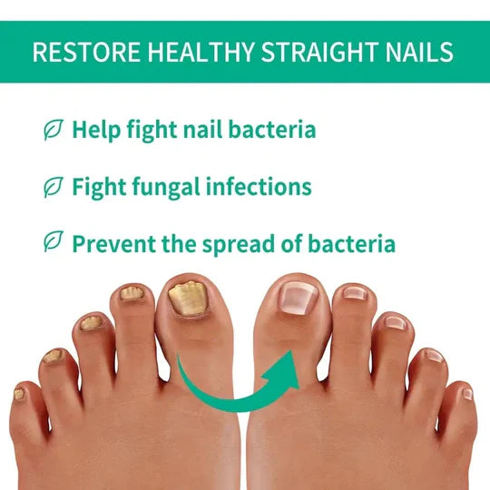 Nail fungus solution