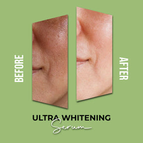 Ultra Whitening Serum!